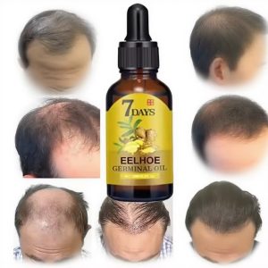 d'EELHOE Germinal Oil ou EELHOE Ginger Germinal Hair Growth Oil